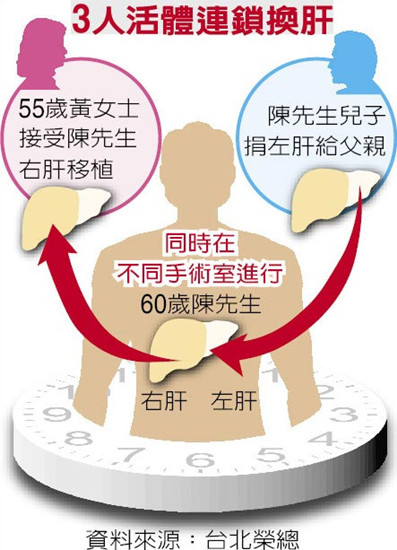 全臺首例臺北榮總醫院完成“3人活體連鎖換肝”